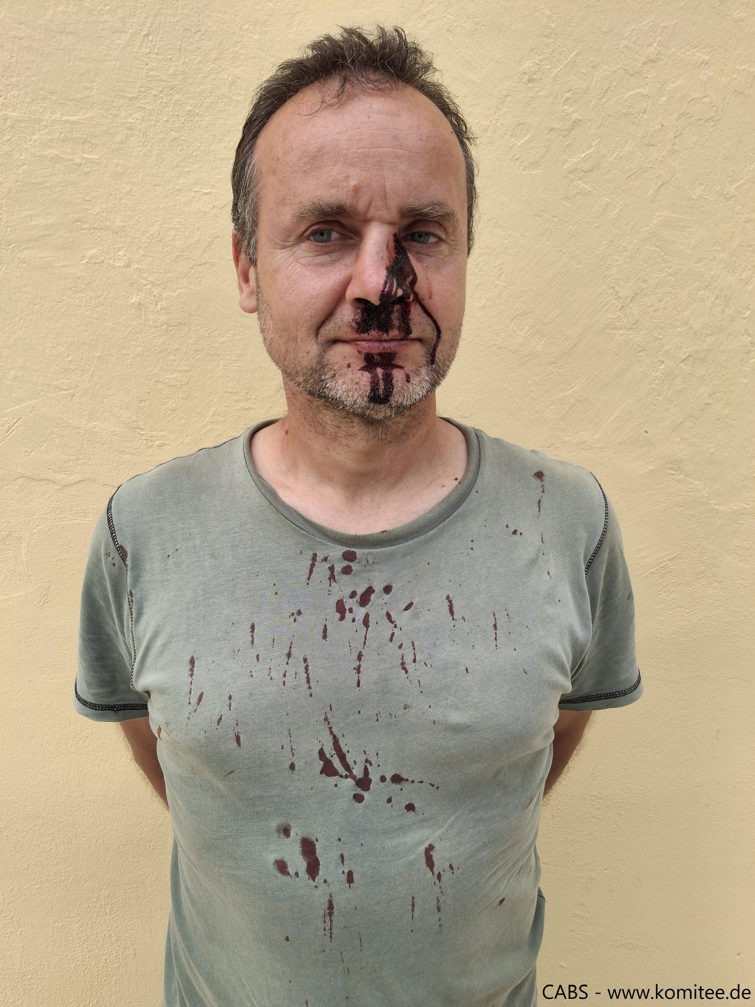 Hunters on Zakynthos Greece have broken the nose of a Slovenian committee member CABS
